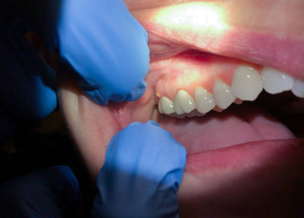Best Emergency Gum Pain Relief  in Comstock Northwest, MI